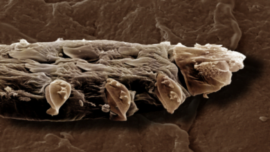 كائنات Demodex .. وجهك مغطى بالآلاف منها