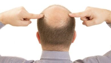 مشكلة تساقط الشعر