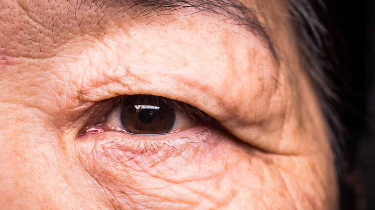 شيخوخة الجسم المبكرة