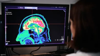 بداية النهاية.. اختراق طبي قد يضع حدا للزهايمر