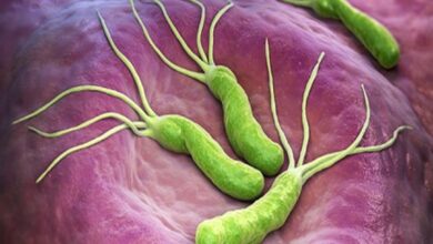 جرثومة المعدة